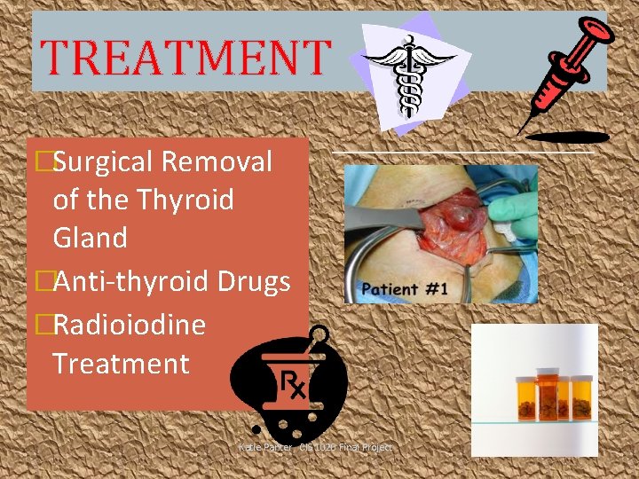 TREATMENT �Surgical Removal of the Thyroid Gland �Anti-thyroid Drugs �Radioiodine Treatment Katie Panter CIS