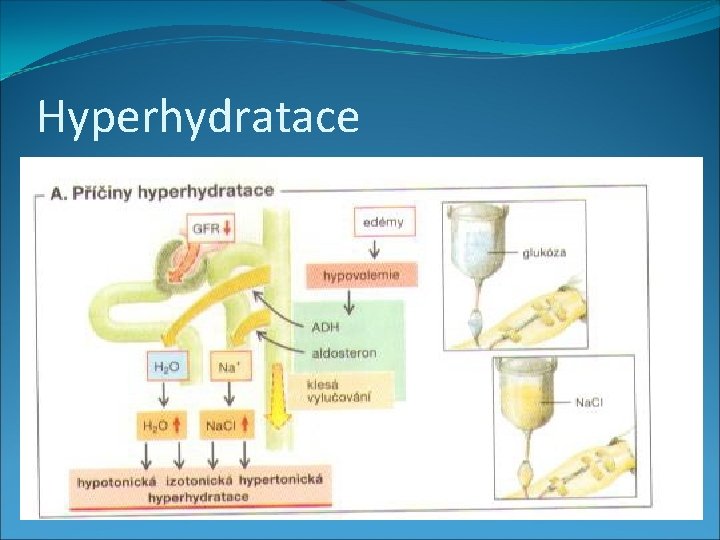 Hyperhydratace 