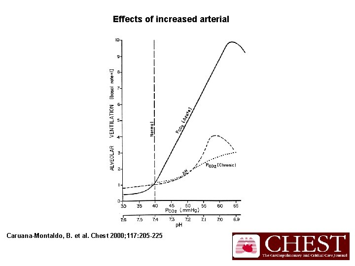 Effects of increased arterial Caruana-Montaldo, B. et al. Chest 2000; 117: 205 -225 