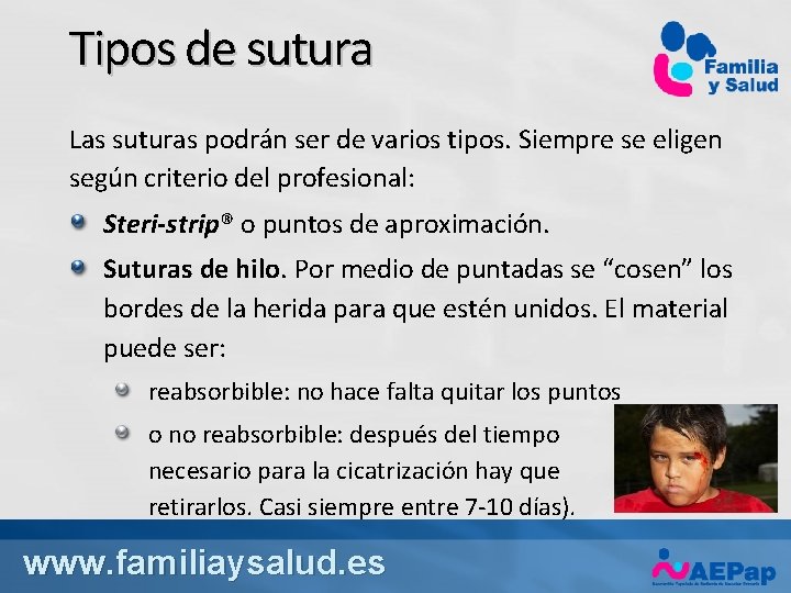 Tipos de sutura Las suturas podrán ser de varios tipos. Siempre se eligen según