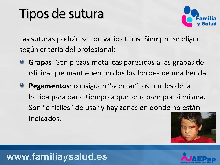 Tipos de sutura Las suturas podrán ser de varios tipos. Siempre se eligen según