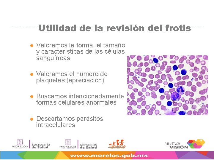 Utilidad de la revisión del frotis l Valoramos la forma, el tamaño y características