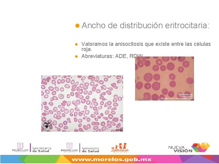 l Ancho l l de distribución eritrocitaria: Valoramos la anisocitosis que existe entre las