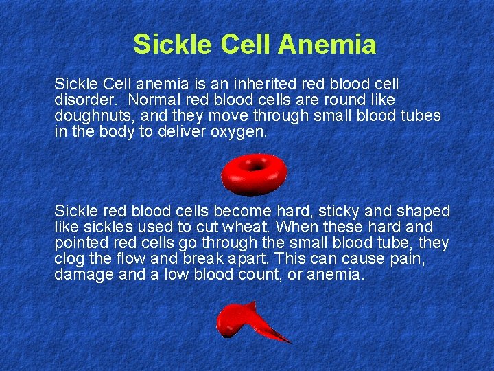 Sickle Cell Anemia Sickle Cell anemia is an inherited red blood cell disorder. Normal