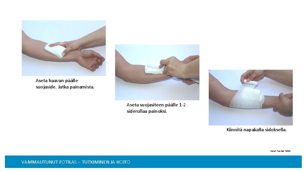 Aseta haavan päälle suojaside. Jatka painamista. Aseta suojasiteen päälle 1 -2 siderullaa painoksi. Kiinnitä