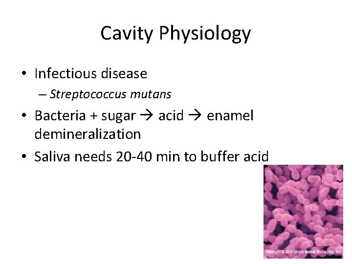Cavity Physiology • Infectious disease – Streptococcus mutans • Bacteria + sugar acid enamel