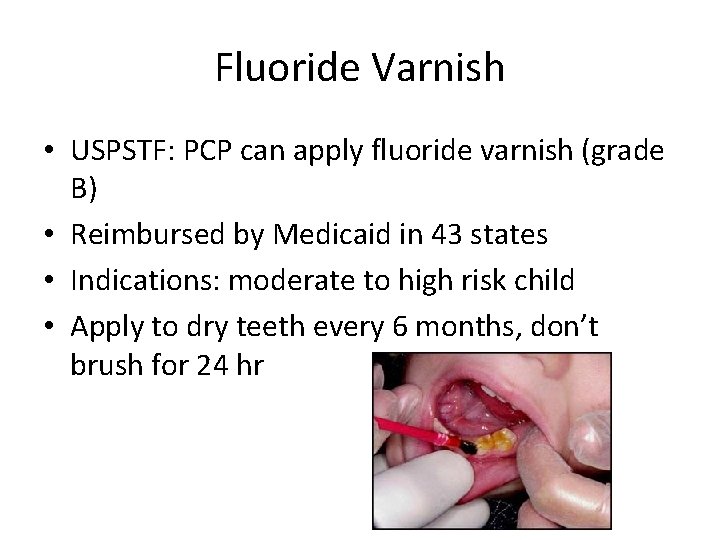 Fluoride Varnish • USPSTF: PCP can apply fluoride varnish (grade B) • Reimbursed by
