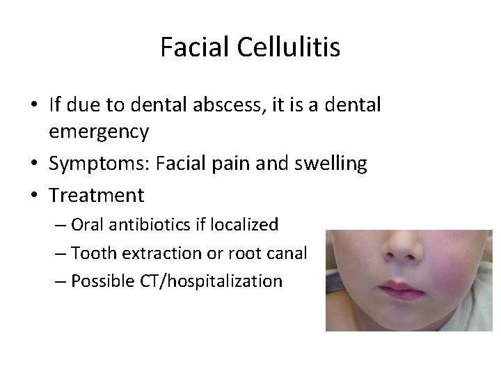 Facial Cellulitis • If due to dental abscess, it is a dental emergency •