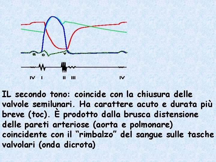 IL secondo tono: coincide con la chiusura delle valvole semilunari. Ha carattere acuto e