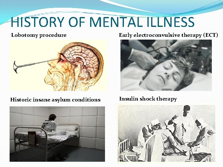 HISTORY OF MENTAL ILLNESS Lobotomy procedure Early electroconvulsive therapy (ECT) Historic insane asylum conditions