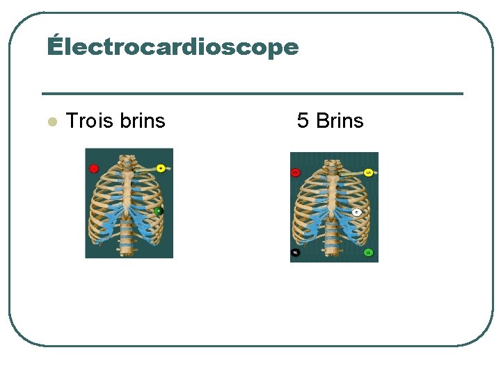 Électrocardioscope l Trois brins 5 Brins 