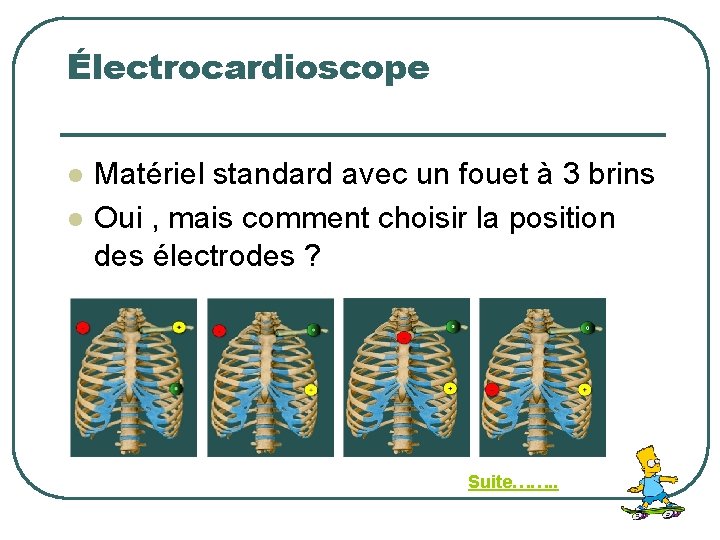 Électrocardioscope l l Matériel standard avec un fouet à 3 brins Oui , mais