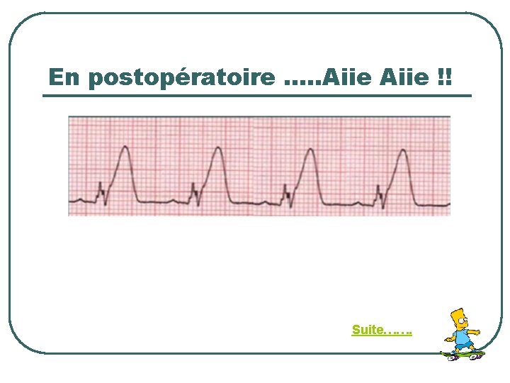 En postopératoire …. . Aiie !! Suite……. 