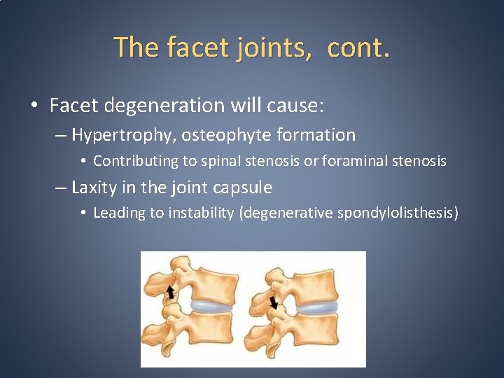 The facet joints, cont. • Facet degeneration will cause: – Hypertrophy, osteophyte formation •