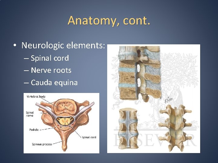 Anatomy, cont. • Neurologic elements: – Spinal cord – Nerve roots – Cauda equina