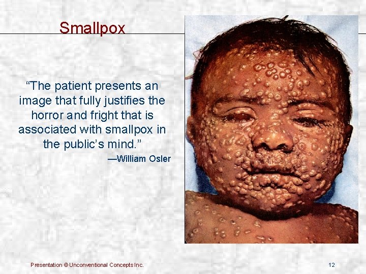 Smallpox “The patient presents an image that fully justifies the horror and fright that