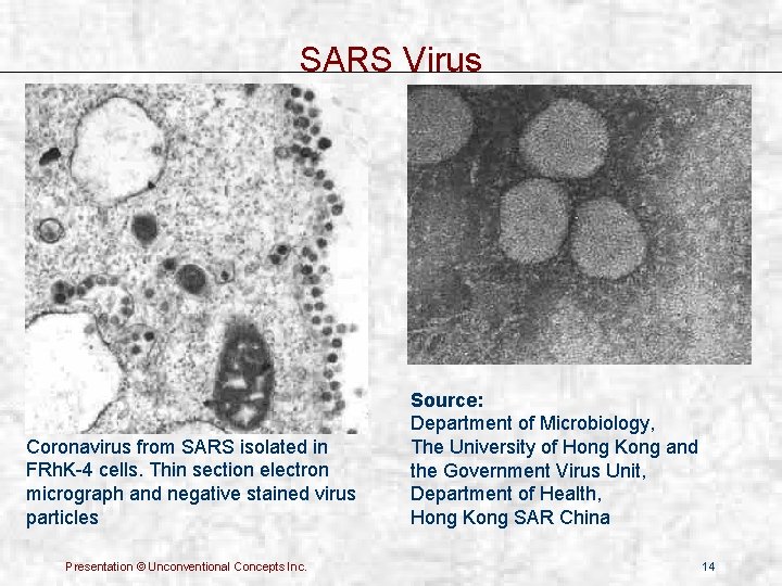 SARS Virus Coronavirus from SARS isolated in FRh. K-4 cells. Thin section electron micrograph