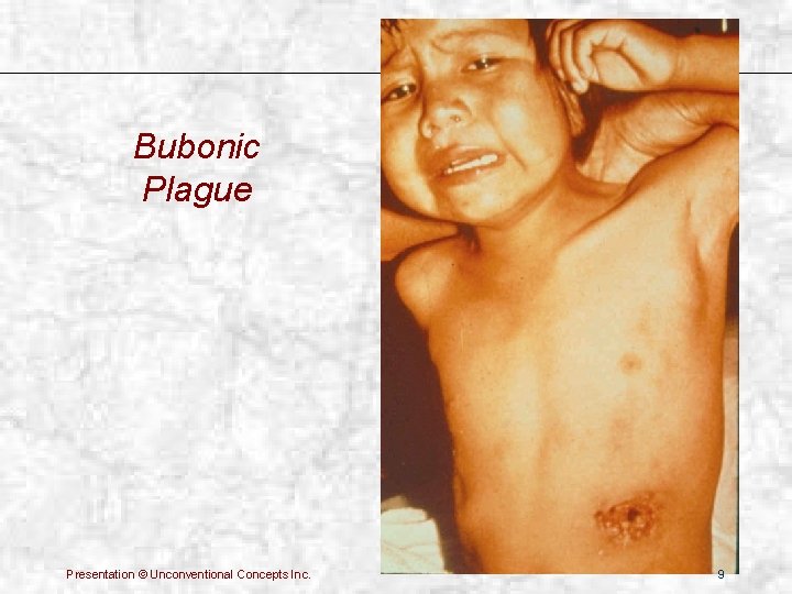 Bubonic Plague Presentation © Unconventional Concepts Inc. 9 