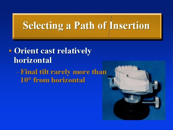 Selecting a Path of Insertion • Orient cast relatively horizontal – Final tilt rarely