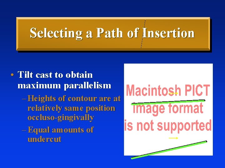 Selecting a Path of Insertion • Tilt cast to obtain maximum parallelism – Heights