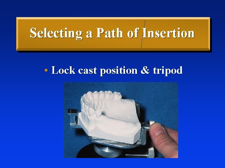 Selecting a Path of Insertion • Lock cast position & tripod 