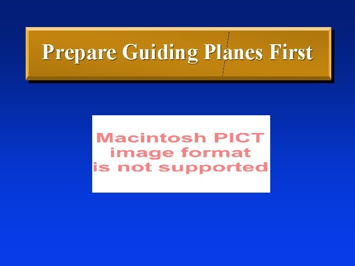 Prepare Guiding Planes First 