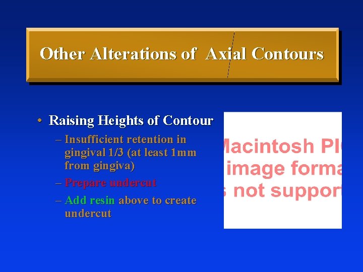Other Alterations of Axial Contours • Raising Heights of Contour – Insufficient retention in