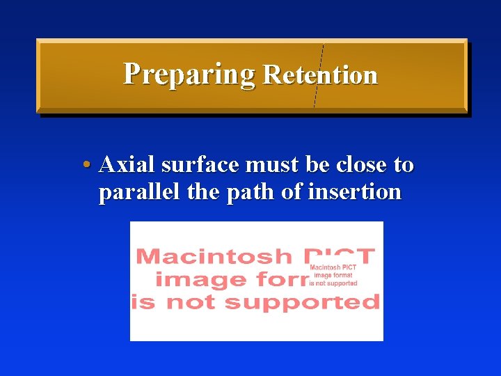 Preparing Retention • Axial surface must be close to parallel the path of insertion