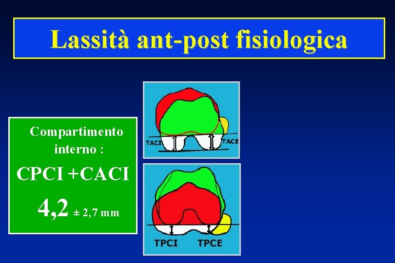 Lassità ant-post fisiologica Compartimento interno : CPCI +CACI 4, 2 ± 2, 7 mm