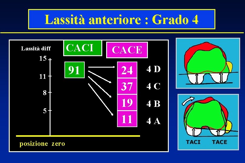 Lassità anteriore : Grado 4 Lassità diff CACI 15 11 8 5 posizione zero