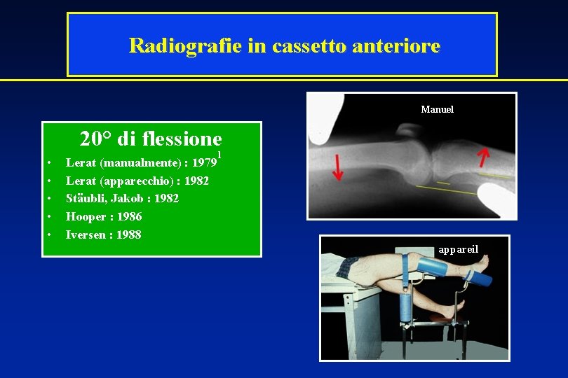 Radiografie in cassetto anteriore Manuel 20° di flessione • • • Lerat (manualmente) :