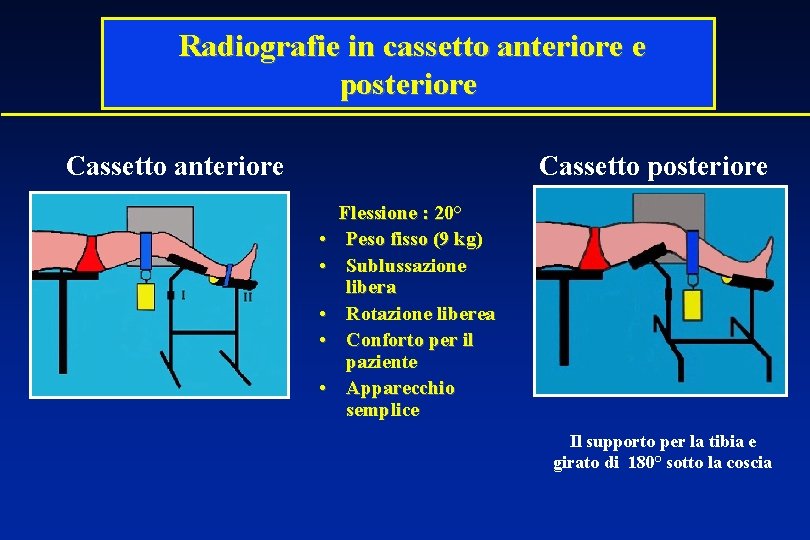 Radiografie in cassetto anteriore e posteriore Cassetto anteriore Cassetto posteriore • • • Flessione