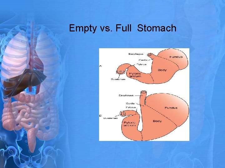 Empty vs. Full Stomach 