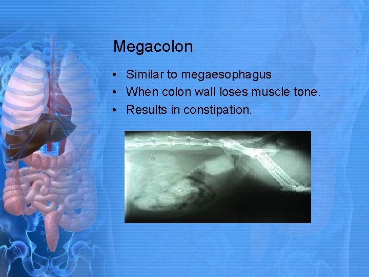 Megacolon • Similar to megaesophagus • When colon wall loses muscle tone. • Results