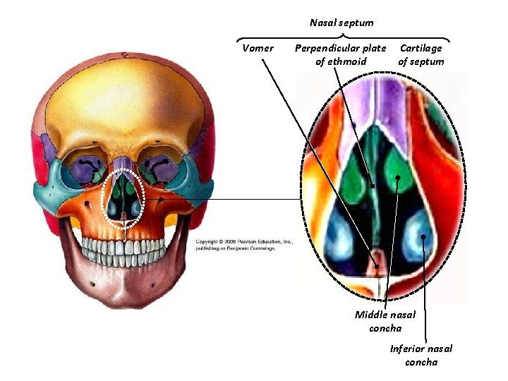 Nasal septum Vomer Perpendicular plate Cartilage of ethmoid of septum Middle nasal concha Inferior