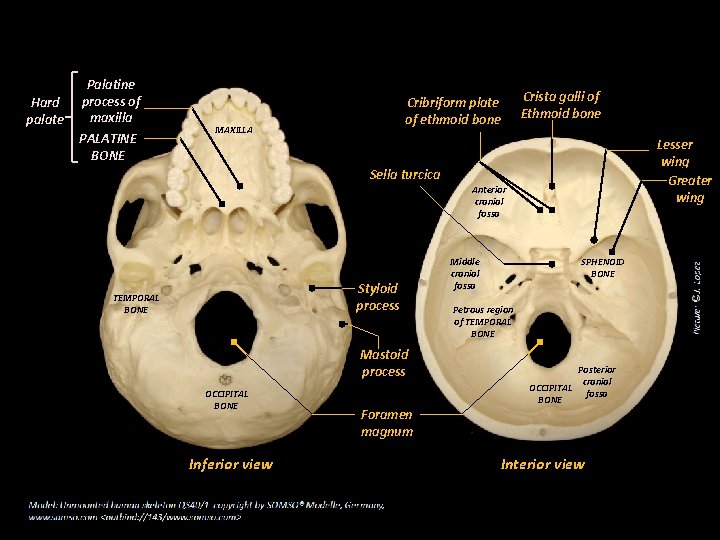 Hard palate Palatine process of maxilla PALATINE BONE Cribriform plate of ethmoid bone MAXILLA