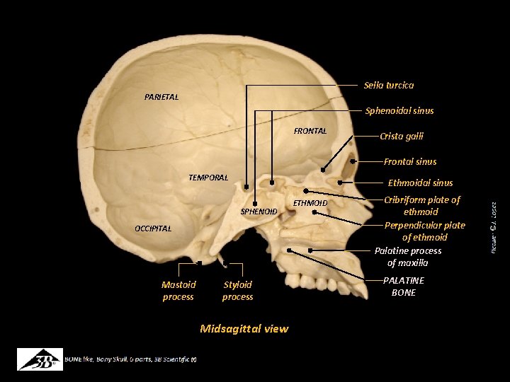 Sella turcica PARIETAL Sphenoidal sinus FRONTAL Crista galli Frontal sinus TEMPORAL Ethmoidal sinus SPHENOID