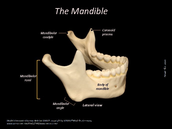 The Mandible Coronoid process Mandibular condyle Mandibular rami Body of mandible Mandibular angle Lateral