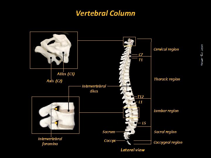 Vertebral Column Cervical region C 7 T 1 Atlas (C 1) Thoracic region Axis