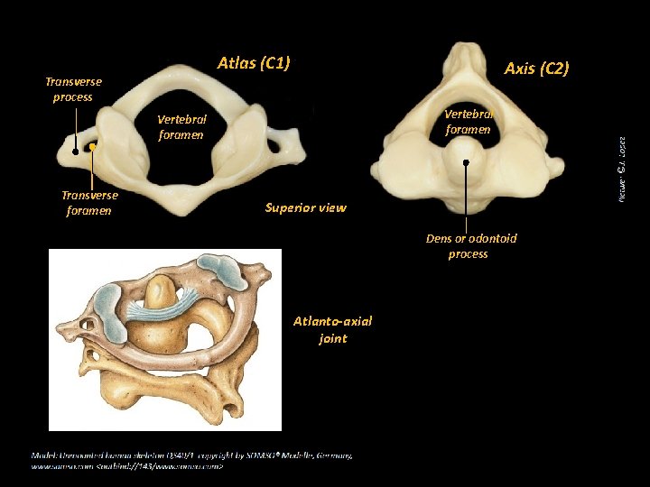 Atlas (C 1) Transverse process Axis (C 2) Vertebral foramen Transverse foramen Superior view