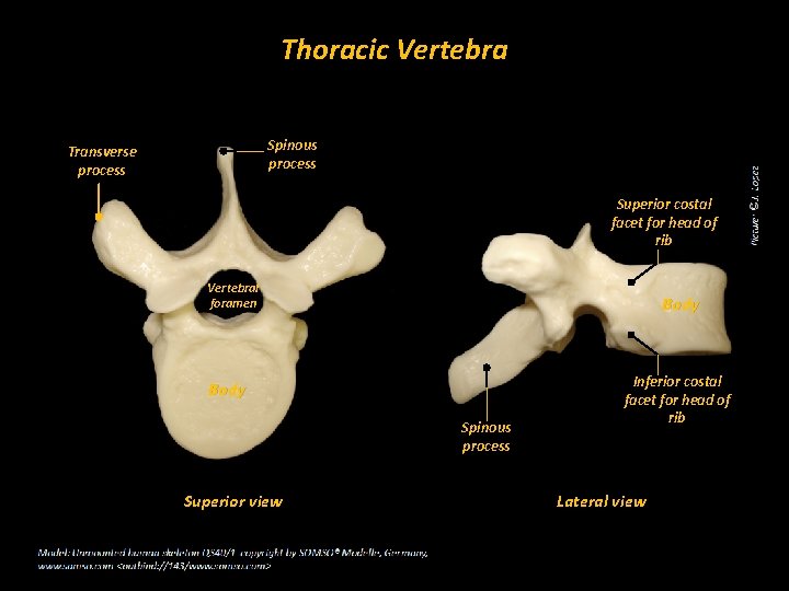 Thoracic Vertebra Spinous process Transverse process Superior costal facet for head of rib Vertebral