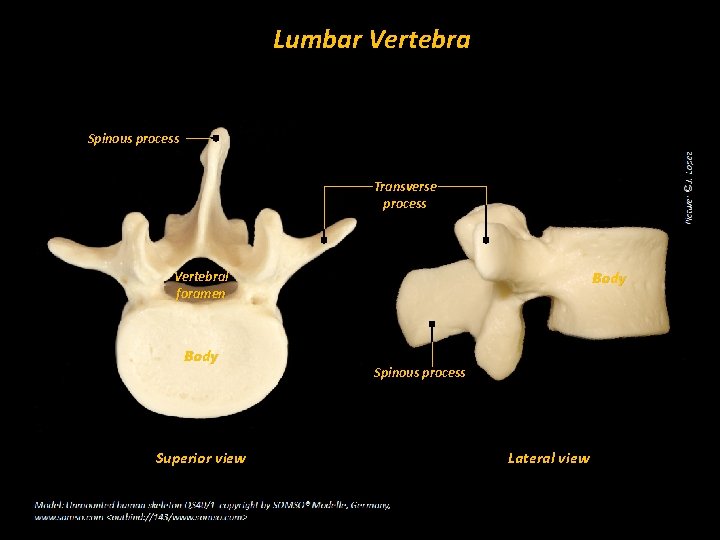 Lumbar Vertebra Spinous process Transverse process Body Vertebral foramen Body Superior view Spinous process