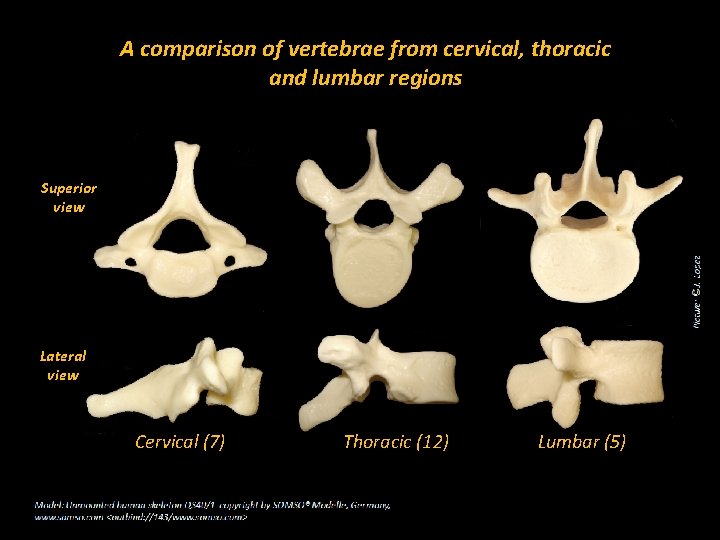 A comparison of vertebrae from cervical, thoracic and lumbar regions Superior view Lateral view
