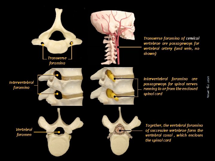 Transverse foramina Intervertebral foramina Vertebral foramen Transverse foramina of cervical vertebrae are passageways for