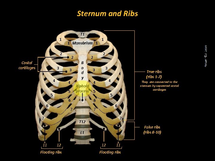 Sternum and Ribs T 1 1 1 Manubrium 1 2 Costal cartilages 3 4