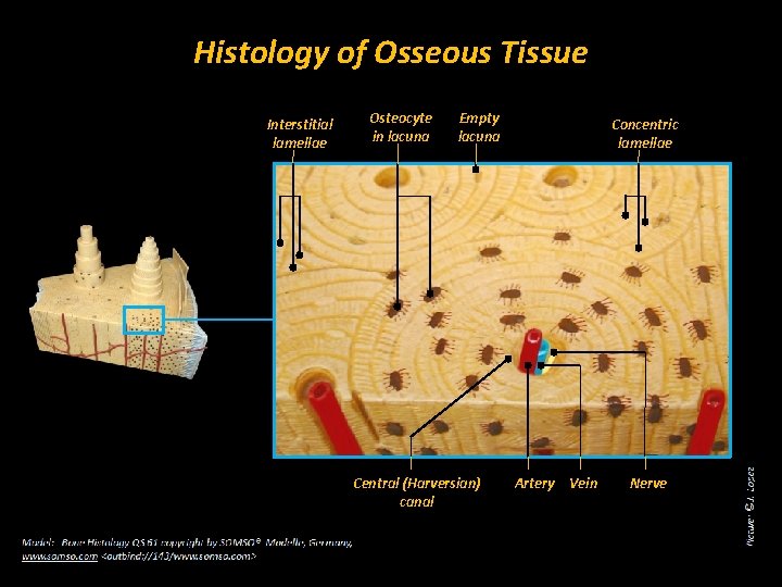 Histology of Osseous Tissue Interstitial lamellae Osteocyte in lacuna Empty lacuna Central (Harversian) canal