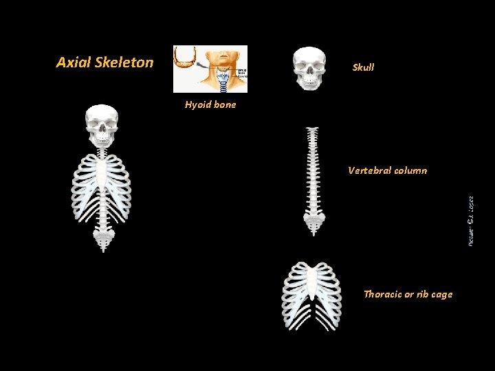 Axial Skeleton Skull Hyoid bone Vertebral column Thoracic or rib cage 