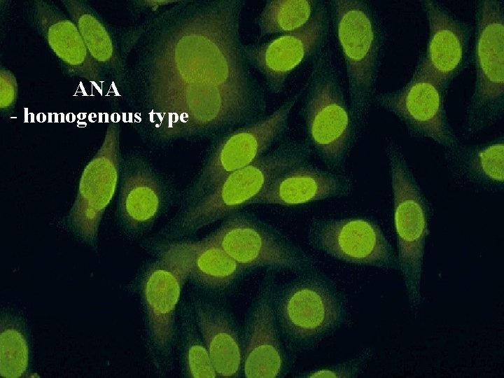 ANA - homogenous type 