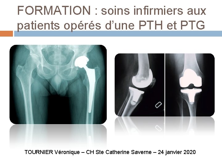 FORMATION : soins infirmiers aux patients opérés d’une PTH et PTG TOURNIER Véronique –