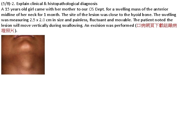 (5/8)-2. Explain clinical & histopathological diagnosis A 15 years old girl came with her